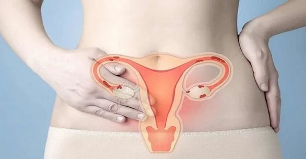 Niêm mạc tử cung mỏng là gì? Vì sao phôi khó làm tổ và cần theo dõi sớm?