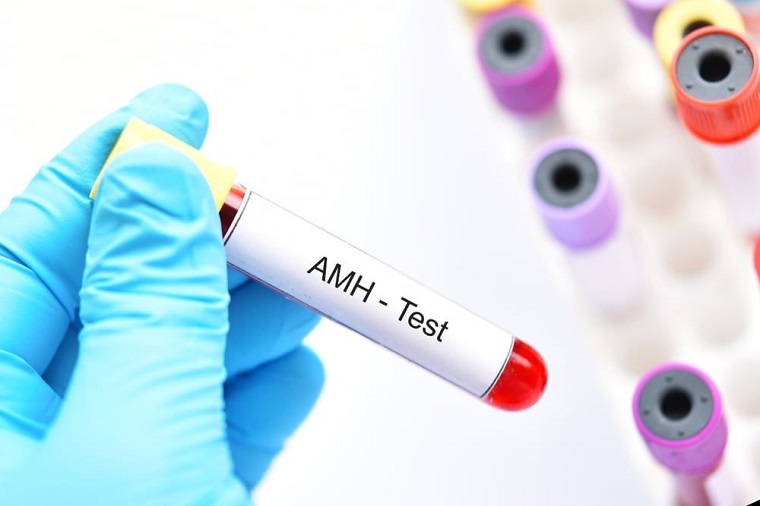 AMH là gì và ý nghĩa thực sự với sức khoẻ buồng trứng